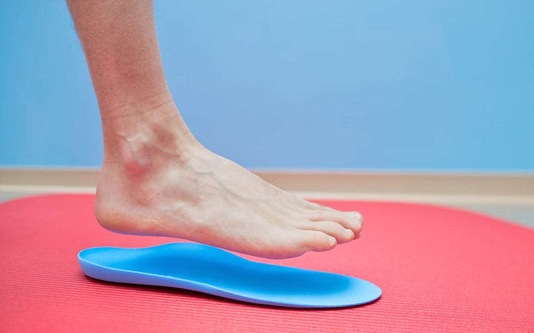Foot on orthopedic insoles medical foot correction.